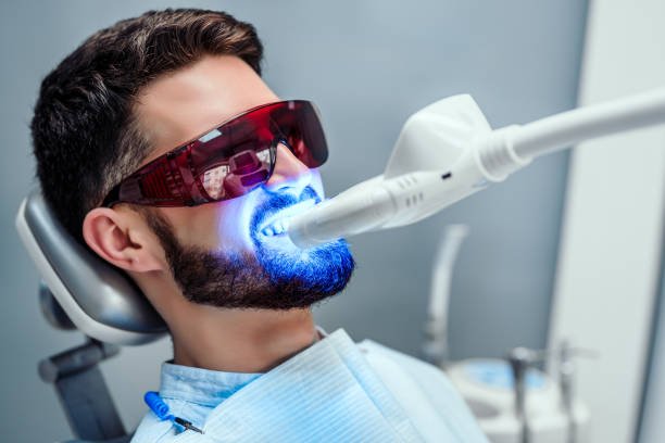 luminescence teeth whitening reviews